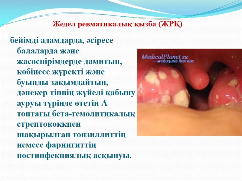 Жедел ревматикалық қызба (ЖРҚ)  бейімді адамдарда, әсіресе балаларда және жасөспірімдерде дамитын, көбінесе жүректі